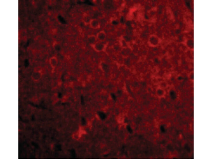 Immunofluorescence of GPAT1 Antibody