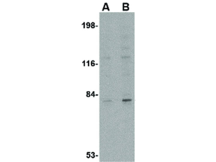 Western Blot of GPAT1 Antibody