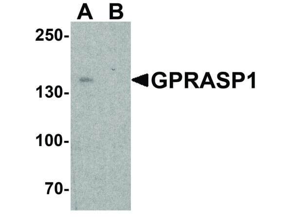 Western Blot of GPRASP1 Antibody