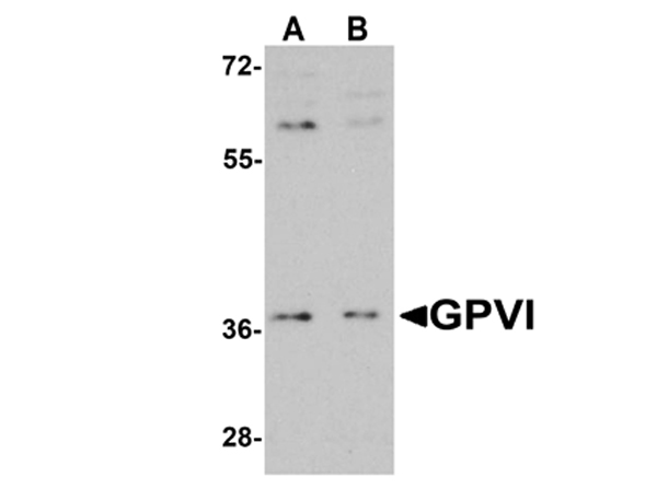 Western Blot of Anti-GPVI Antibody