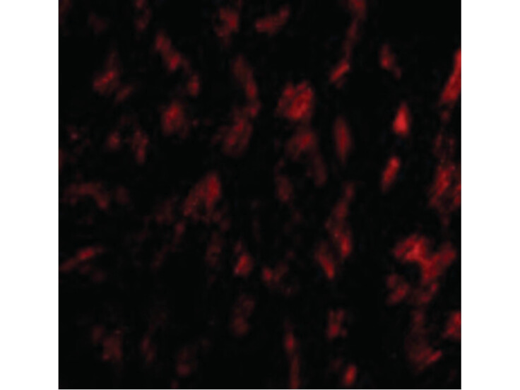 Immunofluorescence of GPVI Antibody