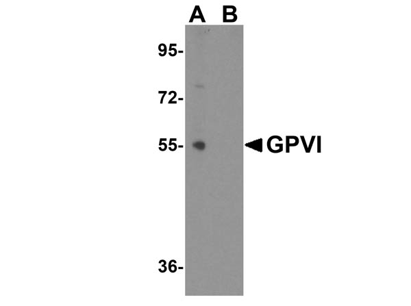 Western Blot of GPVI Antibody