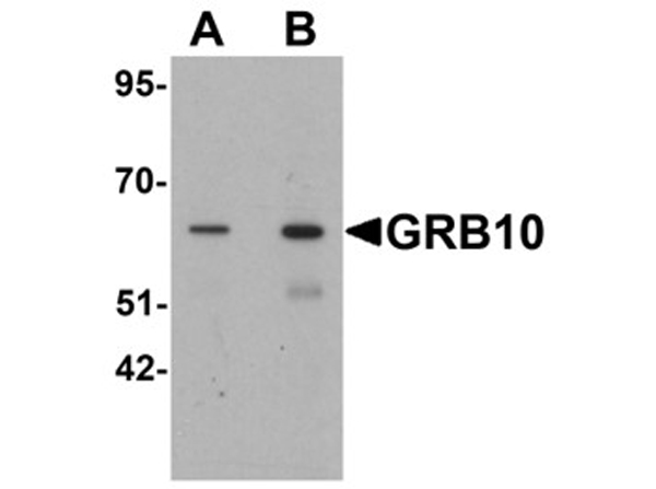 Western blot analysis of GRB10