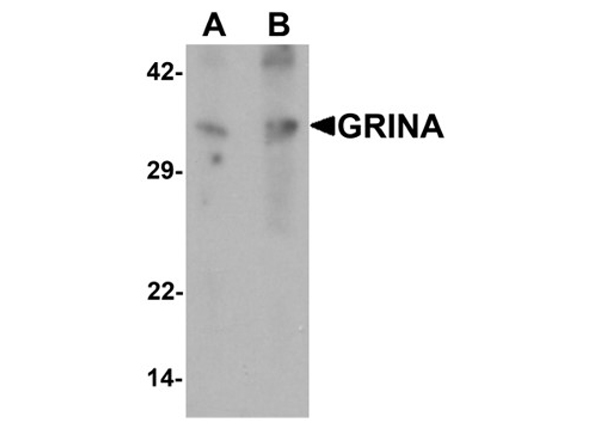 Western blot analysis of GRINA