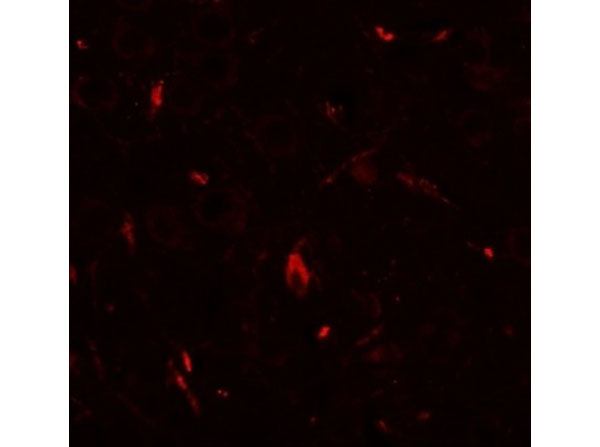Immunofluorescence of GRIP1