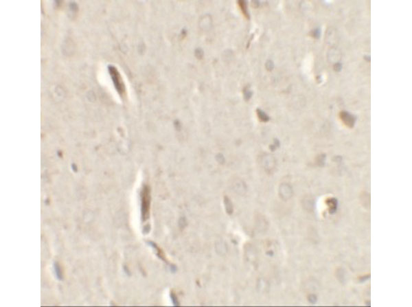 Immunohistochemistry of GRIP1