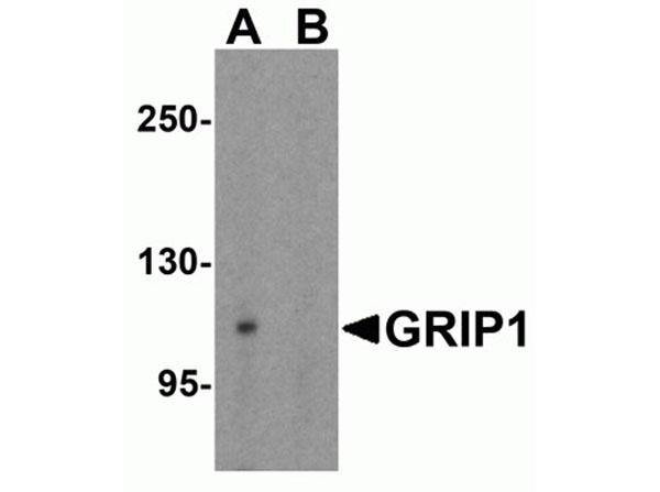 Western blot analysis of GRIP1