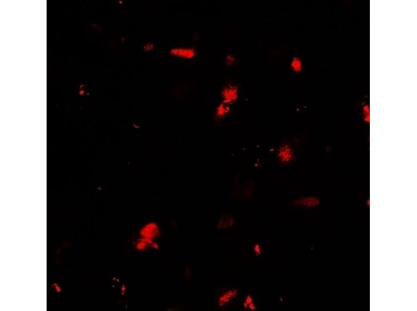 Immunofluorescence of GRK6