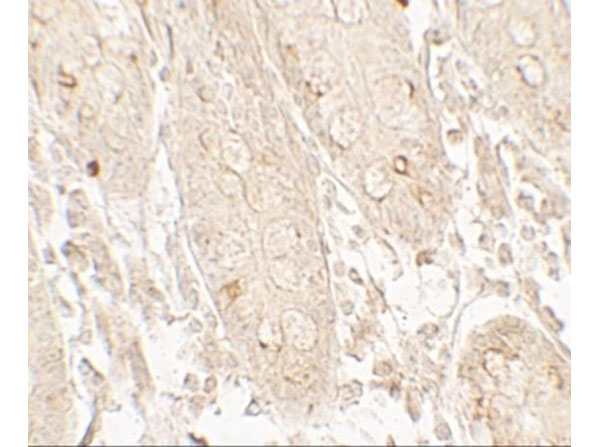 Immunohistochemistry of GRK6
