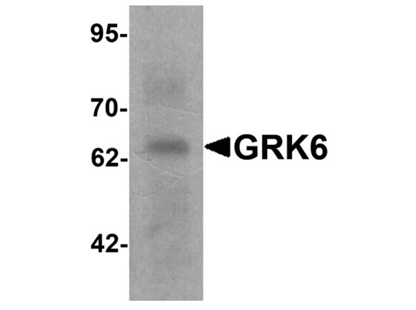 Western blot of GRK6
