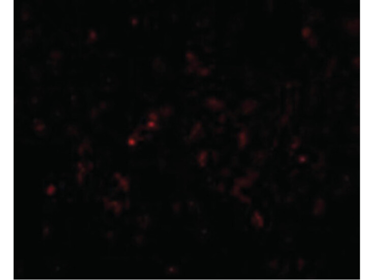Immunofluorescence of GSTP1 Antibody