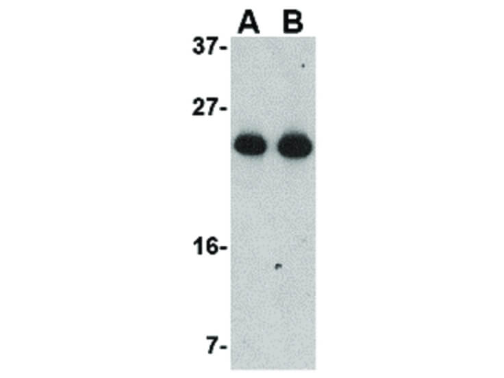 Western Blot of GSTP1 Antibody