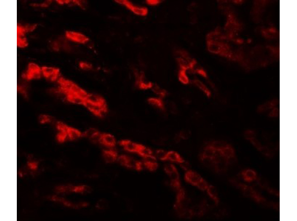 Immunofluorescence of GZF1