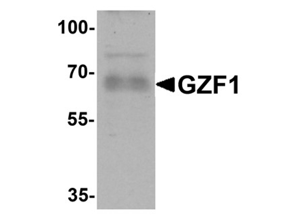 Western blot analysis of GZF1