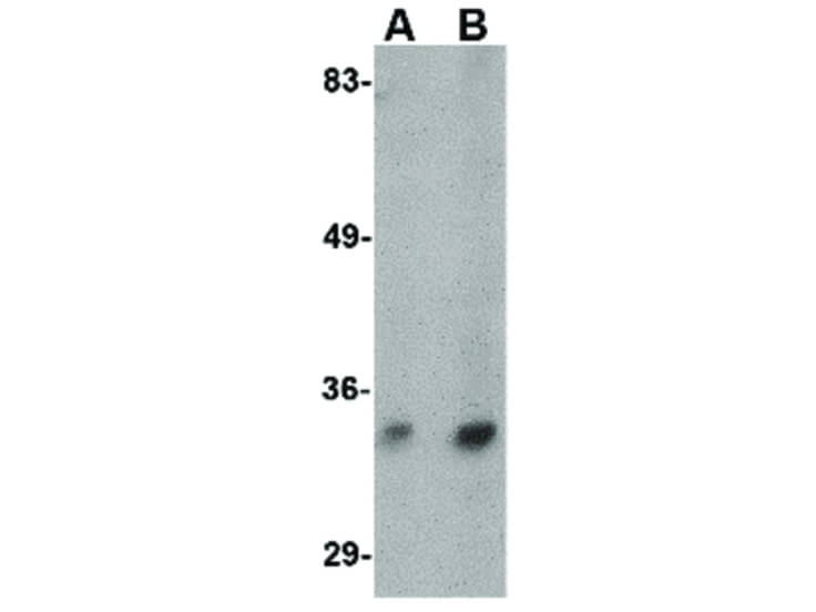 Western Blot of Hax1b Antibody