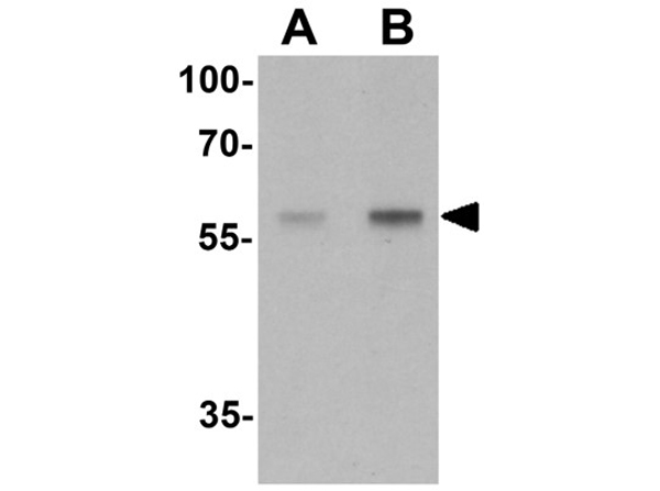 Western blot analysis of HEPACAM2