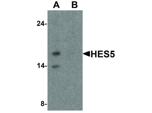 Western Blot of HES5 Antibody