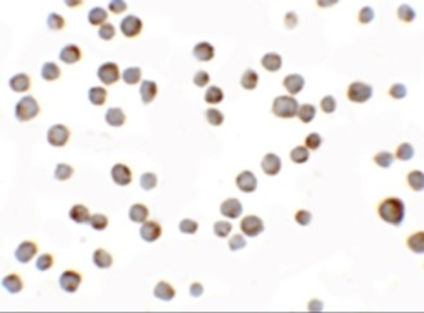 Immunocytochemistry of HIG1