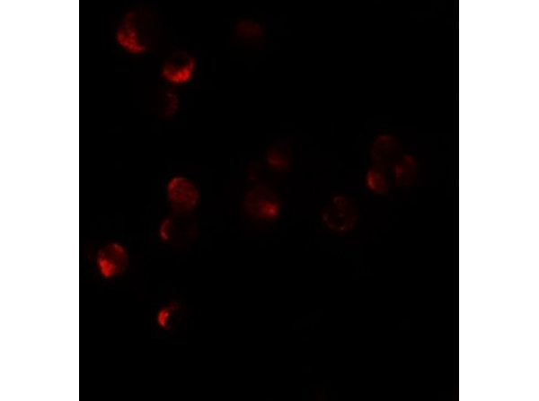 Immunofluorescence of HIG1