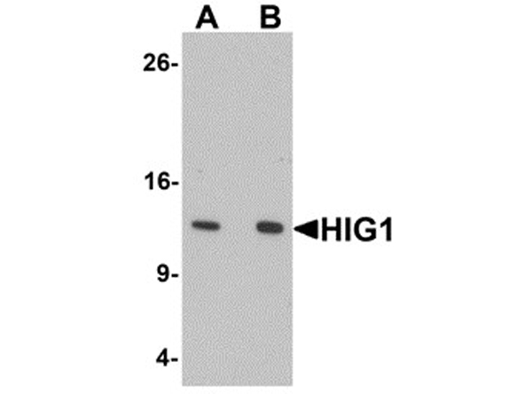 Western blot analysis of HIG1