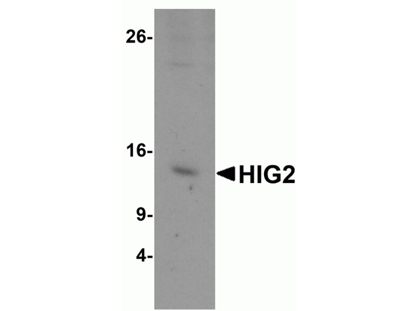 Western blot analysis of HIG2