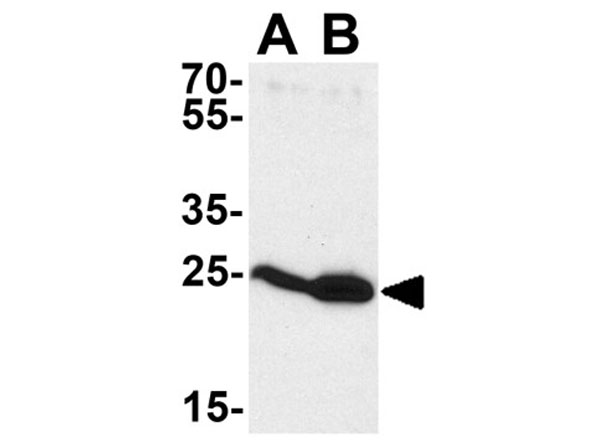 Western blot of HIV-1 p24
