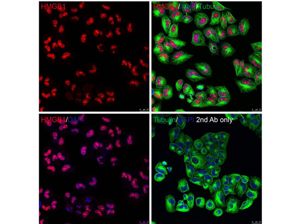 Immunofluorescence of HMGB1