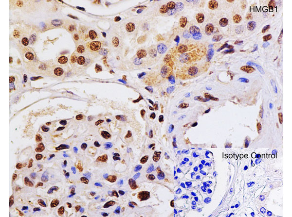 Immunohistochemistry of HMGB1