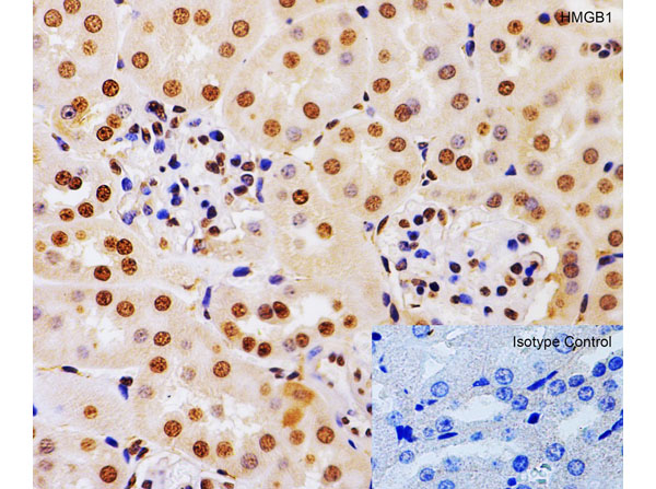 Immunohistochemistry of HMGB1