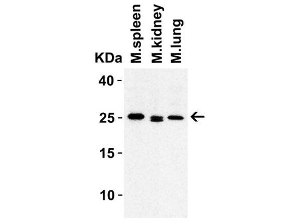 Western Blot of HMGB1