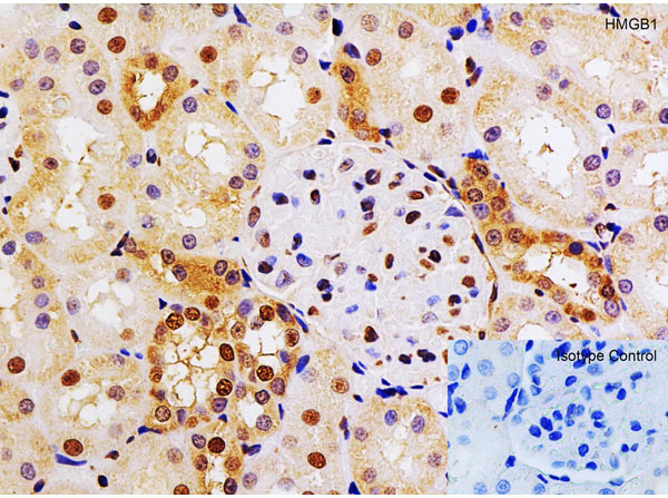 Immunohistochemistry of HMGB1