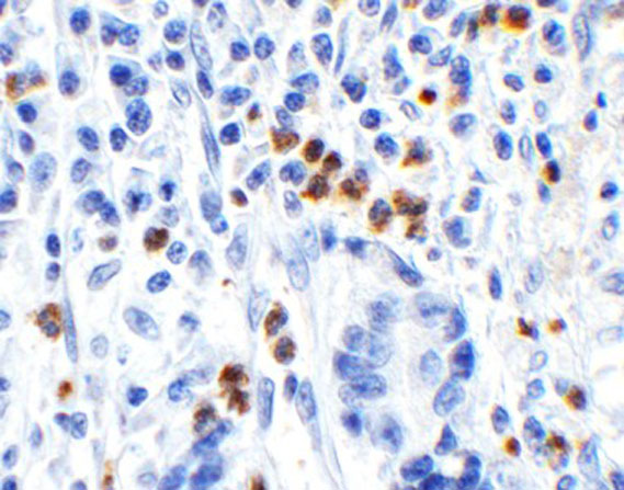 Immunohistochemistry of HMGB1