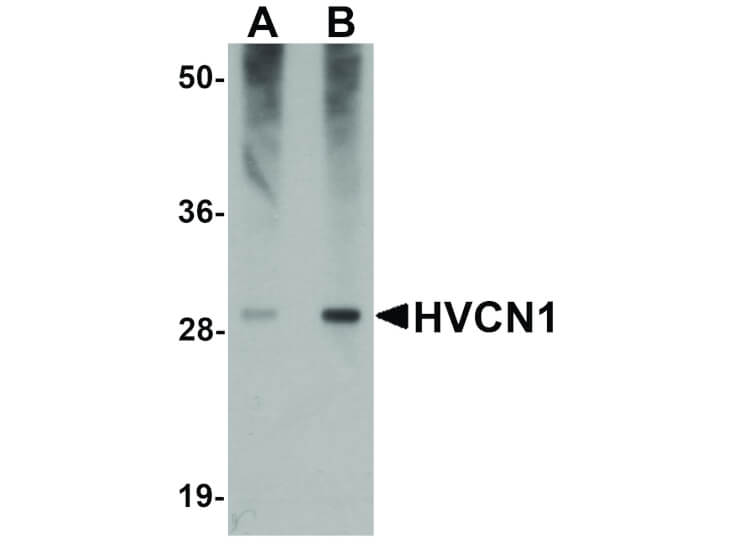 Western Blot of HVCN1 Antibody