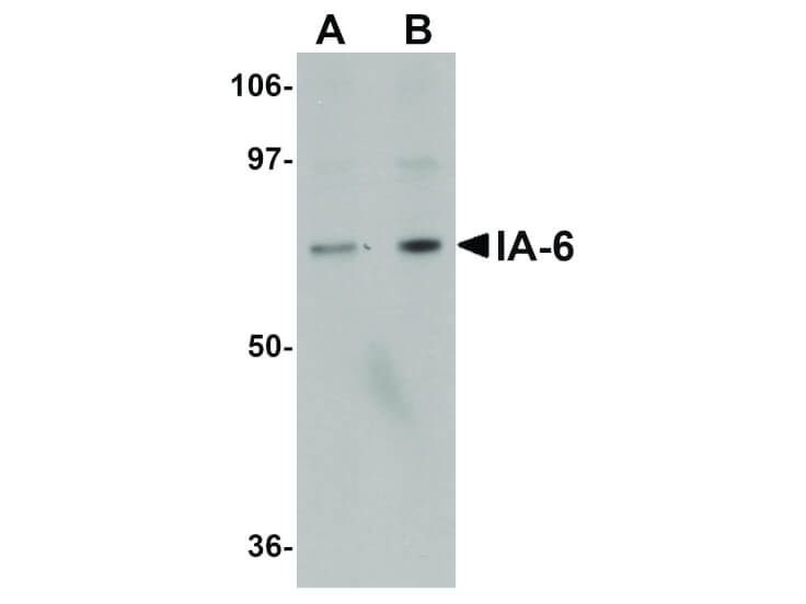 Western Blot of IA-6 Antibody