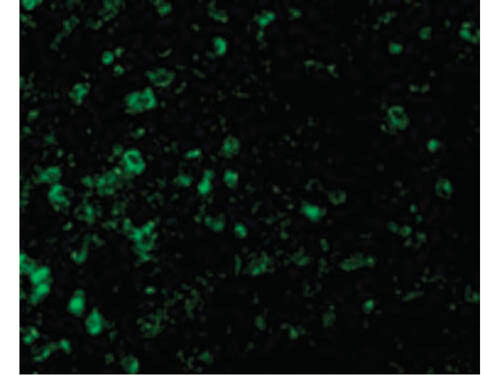 Immunofluorescence of ICAD Antibody