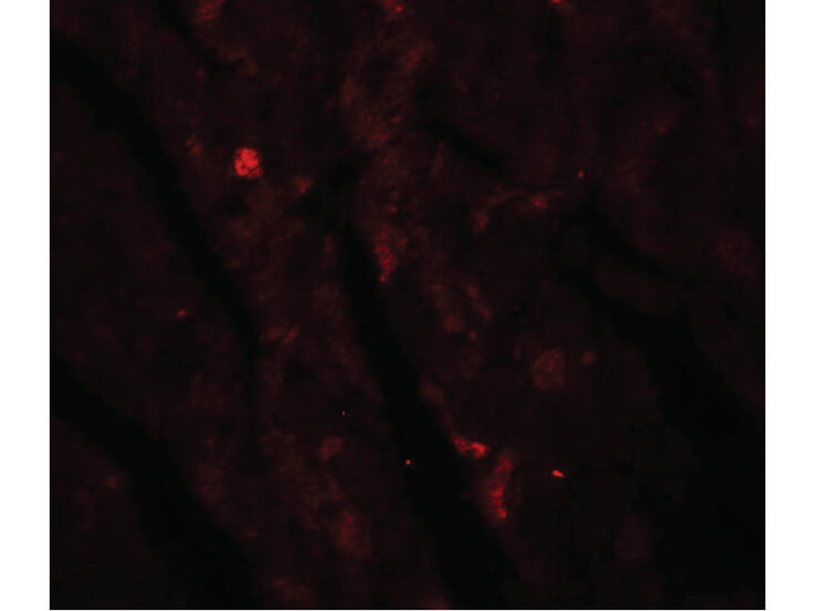 Immunofluorescence of IDH2 Antibody