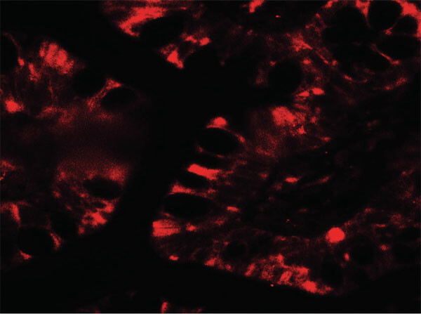 Immunofluorescence of IFIT1 Antibody