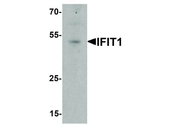 Western Blot of IFIT1 Antibody