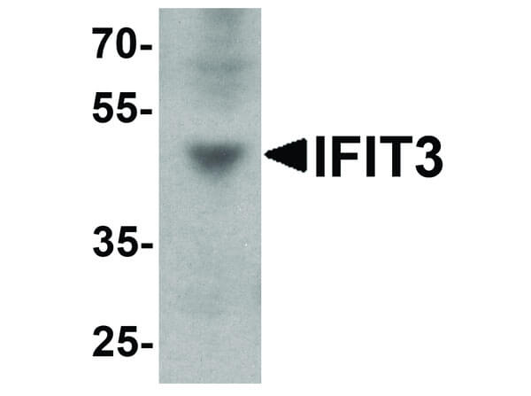 Western Blot of IFIT3 Antibody