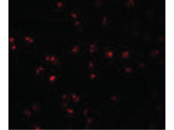 Immunofluorescence of IFITM1 Antibody