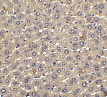 Immunohistochemistry Validation of IFN-beta