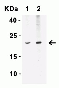 Western Blot using IFN beta