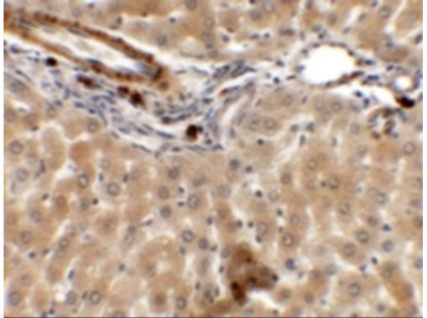Immunohistochemistry of IFTLD1
