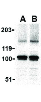 Western Blot of IKAP Antibody