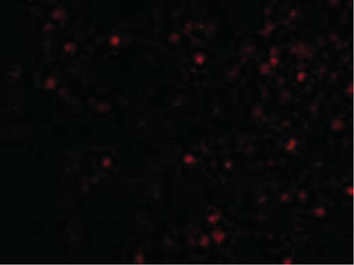 Immunofluorescence of IKAP Antibody