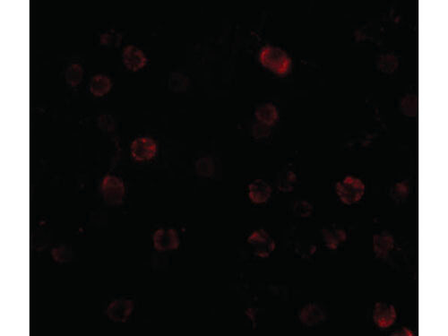 Immunofluorescence of IKK alpha Antibody