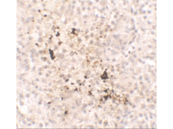 Immunohistochemistry of IL-15