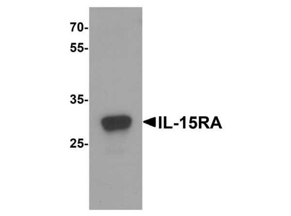 Western blot analysis of IL-15RA