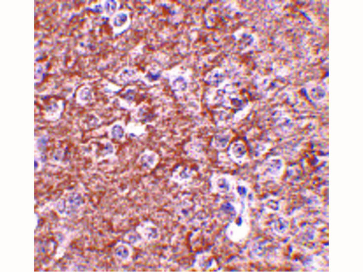 IL-16 Antibody