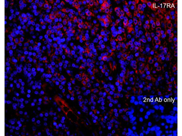 Immunofluorescence of IL-17RA